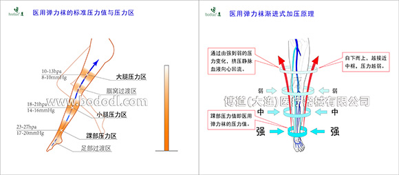 渐进式加压原理与医用弹力袜